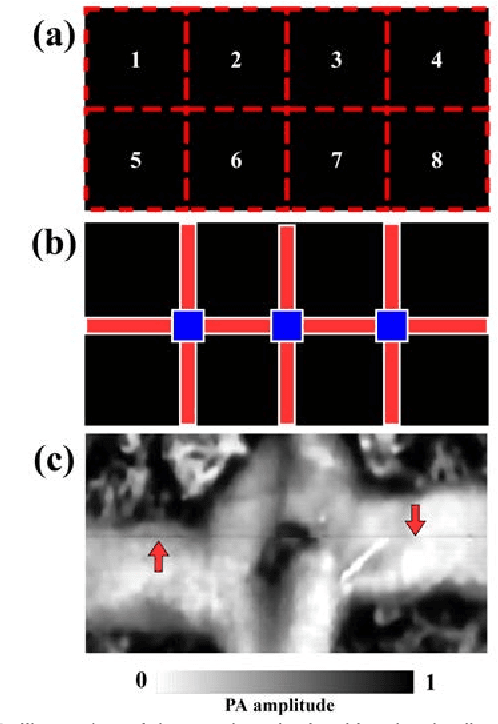 Figure 3 for Reconstructing undersampled photoacoustic microscopy images using deep learning