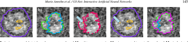 Figure 2 for UI-Net: Interactive Artificial Neural Networks for Iterative Image Segmentation Based on a User Model