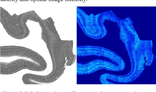 Figure 4 for Automatic Detection of Neurons in NeuN-stained Histological Images of Human Brain