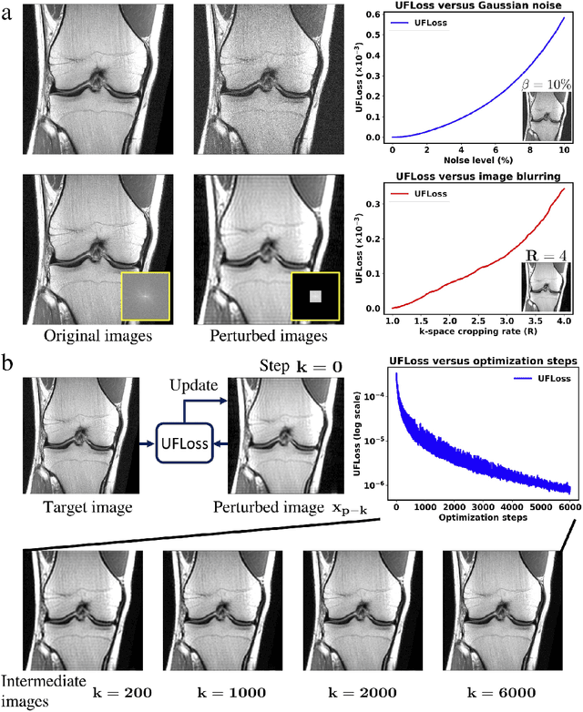 Figure 4 for High Fidelity Deep Learning-based MRI Reconstruction with Instance-wise Discriminative Feature Matching Loss