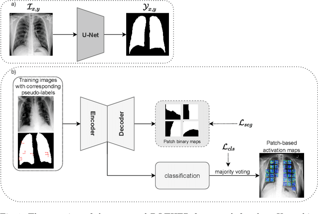 Figure 1 for POTHER: Patch-Voted Deep Learning-based Chest X-ray Bias Analysis for COVID-19 Detection