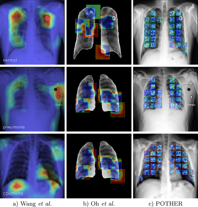 Figure 3 for POTHER: Patch-Voted Deep Learning-based Chest X-ray Bias Analysis for COVID-19 Detection