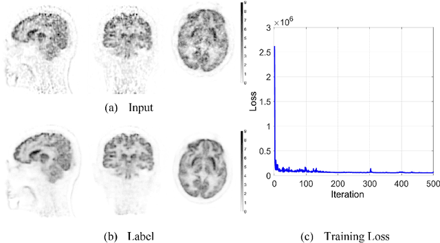 Figure 4 for Clinically Translatable Direct Patlak Reconstruction from Dynamic PET with Motion Correction Using Convolutional Neural Network