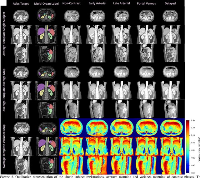 Figure 4 for Multi-Contrast Computed Tomography Healthy Kidney Atlas