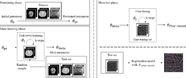 Figure 3 for A Meta-Learning Approach for Medical Image Registration