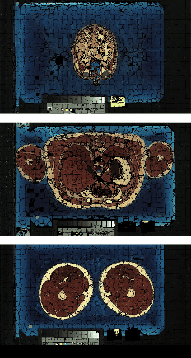 Figure 3 for Scalable Simple Linear Iterative Clustering (SSLIC) Using a Generic and Parallel Approach
