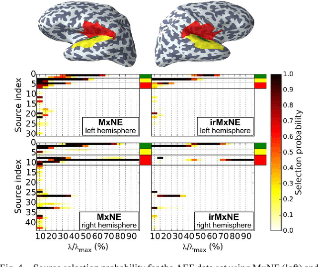 Figure 4 for The iterative reweighted Mixed-Norm Estimate for spatio-temporal MEG/EEG source reconstruction