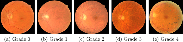 Figure 1 for Self-Supervised Domain Adaptation for Diabetic Retinopathy Grading using Vessel Image Reconstruction