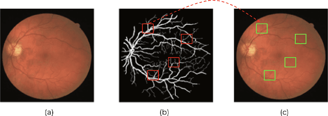 Figure 3 for Self-Supervised Domain Adaptation for Diabetic Retinopathy Grading using Vessel Image Reconstruction