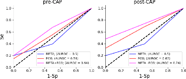 Figure 4 for Atrial Fibrillation Recurrence Risk Prediction from 12-lead ECG Recorded Pre- and Post-Ablation Procedure
