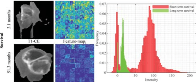 Figure 2 for Modeling of Textures to Predict Immune Cell Status and Survival of Brain Tumour Patients