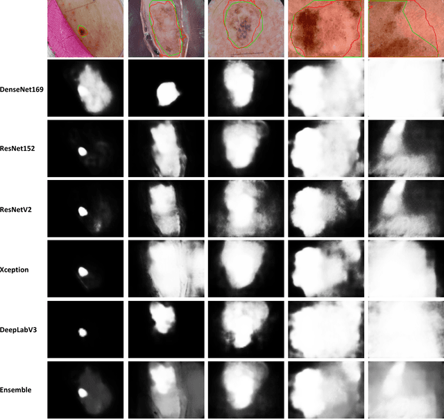 Figure 2 for Leveraging Transfer Learning for Segmenting Lesions and their Attributes in Dermoscopy Images