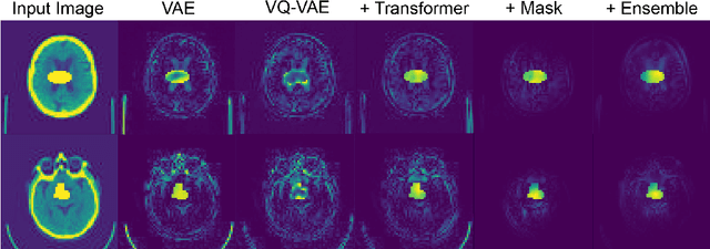Figure 2 for Unsupervised Brain Anomaly Detection and Segmentation with Transformers