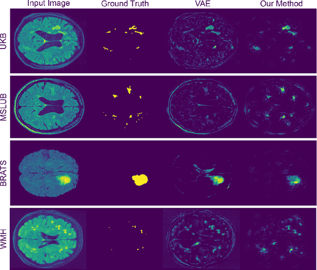 Figure 4 for Unsupervised Brain Anomaly Detection and Segmentation with Transformers