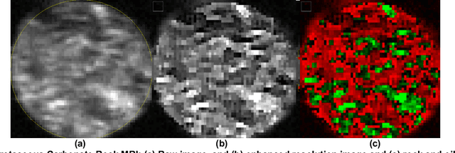 Figure 3 for Machine Learning Guided 3D Image Recognition for Carbonate Pore and Mineral Volumes Determination