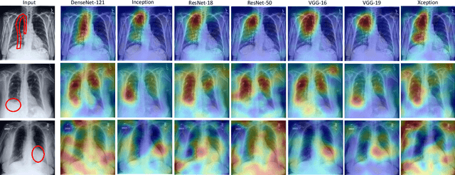 Figure 3 for A Systematic Search over Deep Convolutional Neural Network Architectures for Screening Chest Radiographs