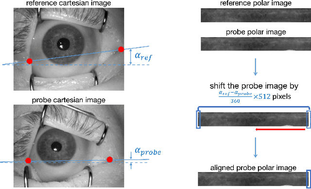 Figure 1 for Post-Mortem Iris Recognition Resistant to Biological Eye Decay Processes