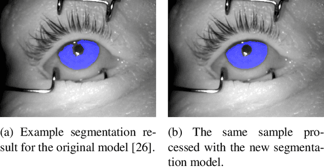 Figure 3 for Post-Mortem Iris Recognition Resistant to Biological Eye Decay Processes