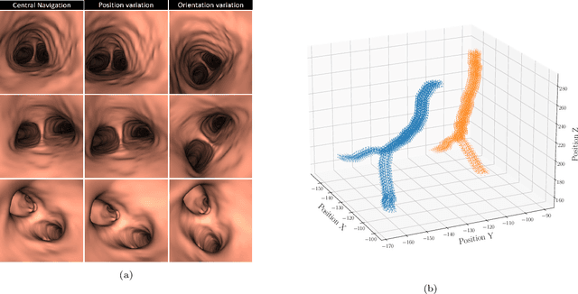 Figure 2 for BronchoPose: an analysis of data and model configuration for vision-based bronchoscopy pose estimation