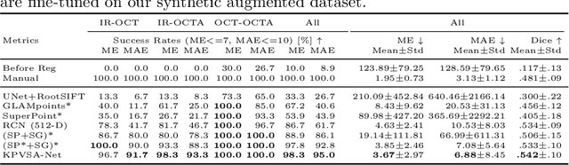 Figure 4 for Multi-modal Retinal Image Registration Using a Keypoint-Based Vessel Structure Aligning Network