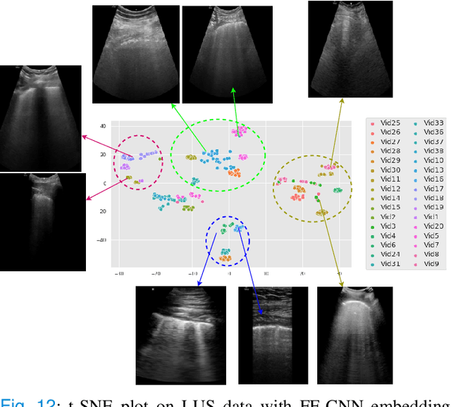 Figure 4 for Physics Driven Domain Specific Transporter Framework with Attention Mechanism for Ultrasound Imaging