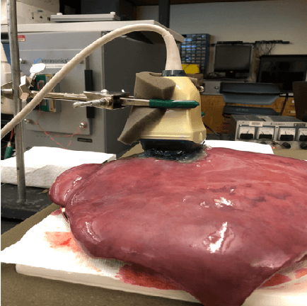 Figure 1 for Ultrafast Ultrasound Imaging for 3D Shear Wave Absolute Vibro-Elastography