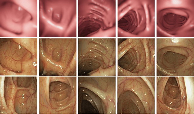 Figure 2 for Depth estimation of endoscopy using sim-to-real transfer