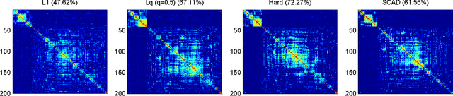 Figure 3 for Nonconvex Regularization Based Sparse and Low-Rank Recovery in Signal Processing, Statistics, and Machine Learning