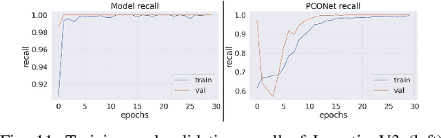 Figure 3 for PCONet: A Convolutional Neural Network Architecture to Detect Polycystic Ovary Syndrome (PCOS) from Ovarian Ultrasound Images