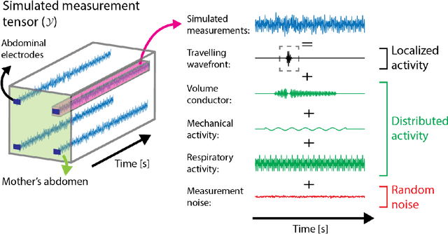 Figure 1 for Estimating uterine activity from electrohysterogram measurements via statistical tensor decomposition