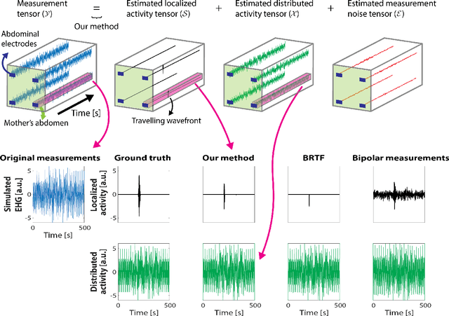 Figure 3 for Estimating uterine activity from electrohysterogram measurements via statistical tensor decomposition