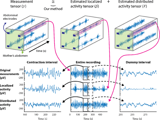 Figure 4 for Estimating uterine activity from electrohysterogram measurements via statistical tensor decomposition