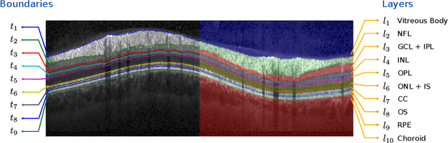 Figure 1 for Probabilistic Intra-Retinal Layer Segmentation in 3-D OCT Images Using Global Shape Regularization