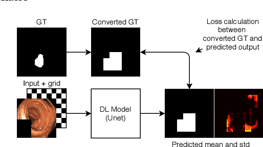 Figure 1 for Pyramid-Focus-Augmentation: Medical Image Segmentation with Step-Wise Focus