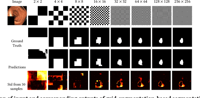 Figure 3 for Pyramid-Focus-Augmentation: Medical Image Segmentation with Step-Wise Focus