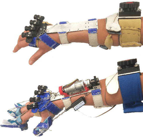 Figure 1 for Design of Spiral-Cable Forearm Exoskeleton to Provide Supination Adjustment for Hemiparetic Stroke Subjects