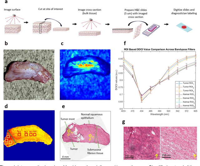 Figure 4 for Dynamic optical contrast imaging for real-time delineation of tumor resection margins using head and neck cancer as a model