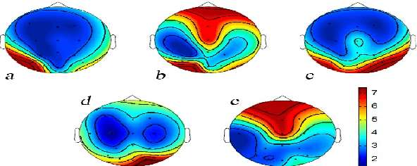 Figure 4 for Control of a 2-DoF robotic arm using a P300-based brain-computer interface