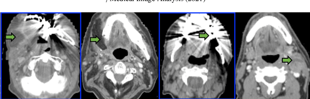 Figure 1 for Nested-block self-attention for robust radiotherapy planning segmentation