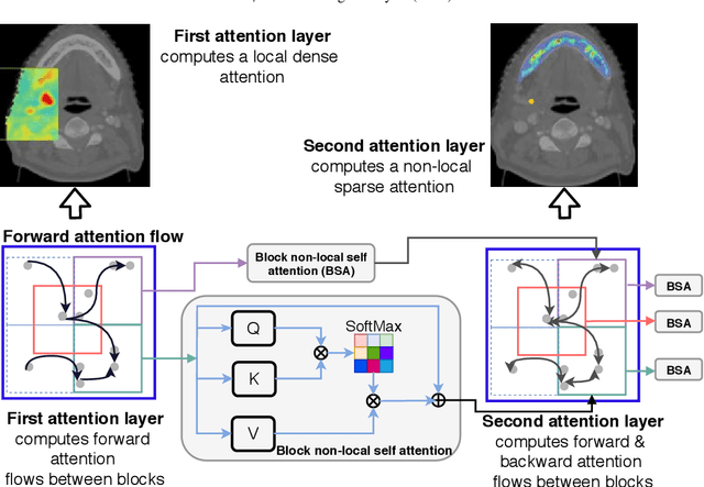 Figure 3 for Nested-block self-attention for robust radiotherapy planning segmentation