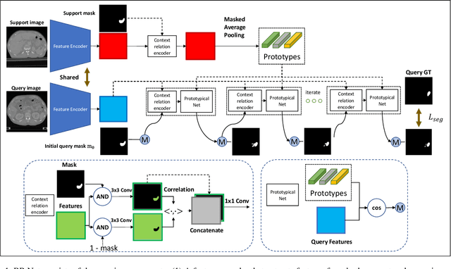 Figure 1 for Recurrent Mask Refinement for Few-Shot Medical Image Segmentation
