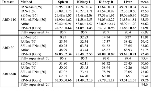 Figure 2 for Recurrent Mask Refinement for Few-Shot Medical Image Segmentation