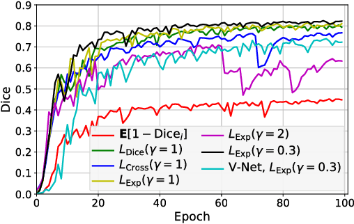 Figure 4 for 3D Segmentation with Exponential Logarithmic Loss for Highly Unbalanced Object Sizes