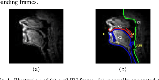 Figure 1 for An error correction scheme for improved air-tissue boundary in real-time MRI video for speech production
