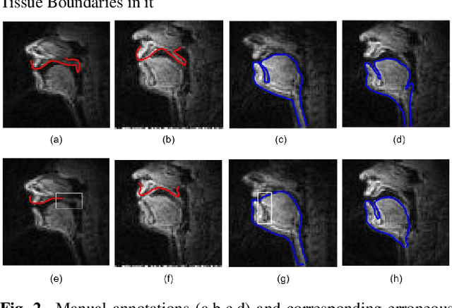 Figure 3 for An error correction scheme for improved air-tissue boundary in real-time MRI video for speech production