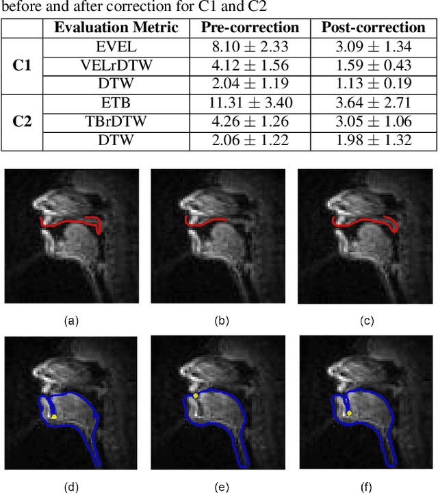 Figure 4 for An error correction scheme for improved air-tissue boundary in real-time MRI video for speech production