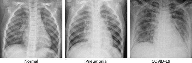 Figure 1 for RCoNet: Deformable Mutual Information Maximization and High-order Uncertainty-aware Learning for Robust COVID-19 Detection