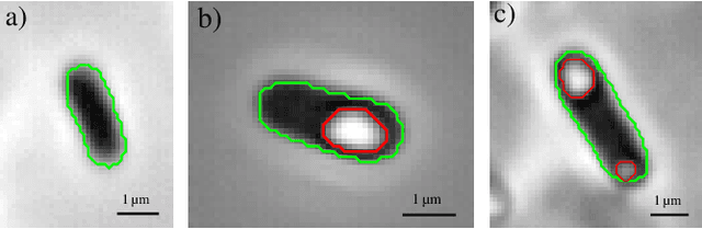 Figure 3 for Automated Characterization of Catalytically Active Inclusion Body Production in Biotechnological Screening Systems