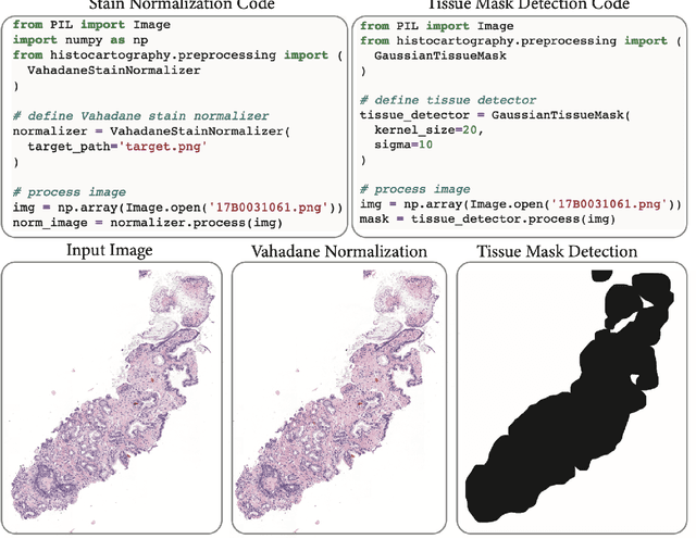 Figure 3 for HistoCartography: A Toolkit for Graph Analytics in Digital Pathology