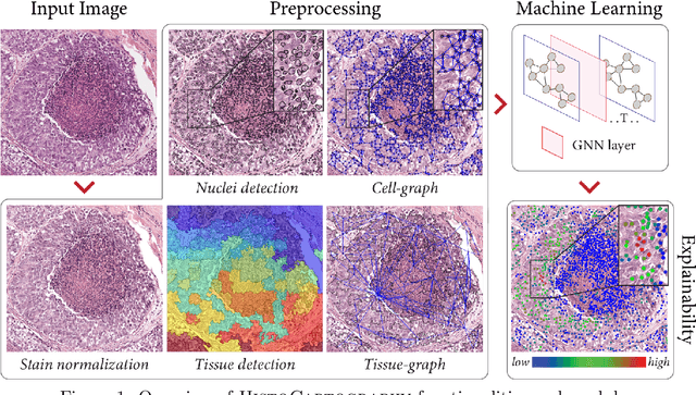 Figure 2 for HistoCartography: A Toolkit for Graph Analytics in Digital Pathology